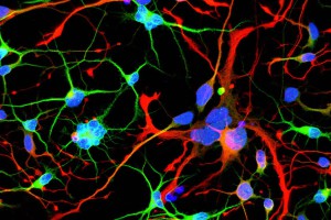 huntingtons-neurons-neuroscinecenws